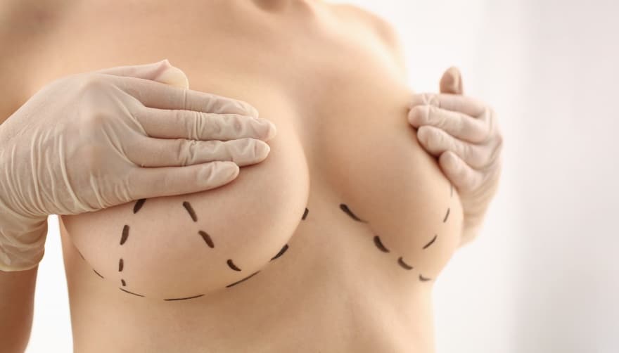 Comment seront les cicatrices après une intervention de chirurgie esthétique ? | Dr Louafi | Paris